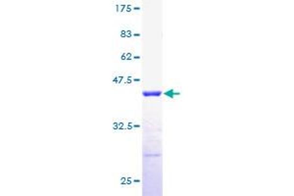 RPLP2 Protein (AA 1-115) (GST tag)