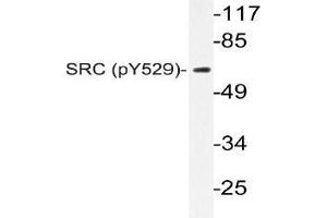 Western blot (WB) analysis of p-c-RAF antibody in extracts from K562 cells.