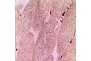 Immunohistochemical analysis of RPL3L staining in human muscle formalin fixed paraffin embedded tissue section. (RPL3L antibody  (Center))