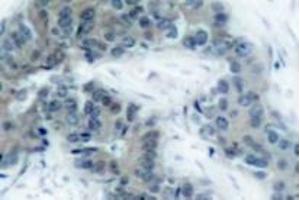 Image no. 1 for anti-Janus Kinase 2 (JAK2) (pTyr1007) antibody (ABIN318056)