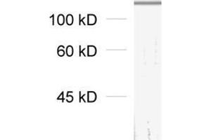 dilution: 1 : 1000, sample: synaptic membrane fraction of rat brain (LP1) (GRIK5 antibody  (C-Term))