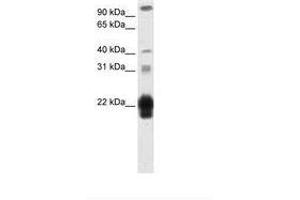 Image no. 2 for anti-Chorionic Somatomammotropin Hormone 1 (Placental Lactogen) (CSH1) (AA 121-170) antibody (ABIN203034) (CSH1 antibody  (AA 121-170))