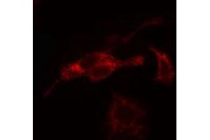 ABIN6266835 staining Hela cells by IF/ICC. (ADPGK antibody  (Internal Region))