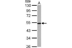 WB Image Cyclin A2 antibody detects CCNA2 protein by Western blot analysis. (Cyclin A antibody)