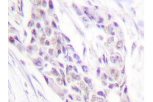 Image no. 1 for anti-Cyclin A1 (CCNA1) antibody (ABIN265378) (Cyclin A1 antibody)