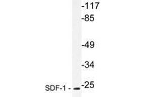 Western blot analysis of SDF-1 Antibody in extracts from HepG2 cells. (CXCL12 antibody)