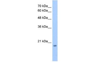 Western Blot showing DNTTIP1 antibody used at a concentration of 1-2 ug/ml to detect its target protein. (DNTTIP1 antibody  (N-Term))