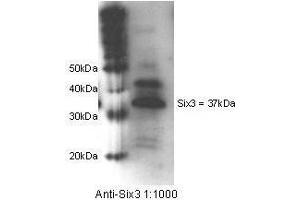 Anti-Six3 Antibody - Western Blot. (SIX3 antibody  (Internal Region))