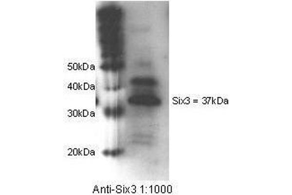 SIX3 Antikörper  (Internal Region)