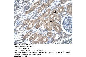 Rabbit Anti-CDH8 Antibody  Paraffin Embedded Tissue: Human Kidney Cellular Data: Epithelial cells of renal tubule Antibody Concentration: 4. (TDO2 antibody  (N-Term))