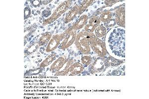 Rabbit Anti-CDH8 Antibody  Paraffin Embedded Tissue: Human Kidney Cellular Data: Epithelial cells of renal tubule Antibody Concentration: 4.