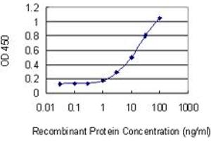 Detection limit for recombinant GST tagged DMD is 0. (Dystrophin antibody  (AA 1-635))