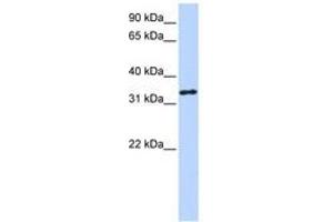 Image no. 1 for anti-3-hydroxyanthranilate 3,4-Dioxygenase (HAAO) (AA 72-121) antibody (ABIN6740761) (HAAO antibody  (AA 72-121))