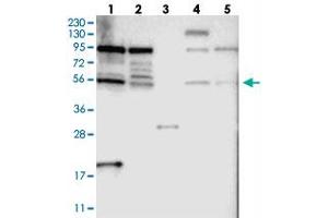 Western blot analysis of Lane 1: RT-4, Lane 2: U-251 MG, Lane 3: Human Plasma, Lane 4: Liver, Lane 5: Tonsil with TOX4 polyclonal antibody  at 1:250-1:500 dilution.