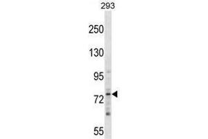 ZNF81 Antibody (N-term) western blot analysis in 293 cell line lysates (35 µg/lane). (ZNF81 antibody  (N-Term))