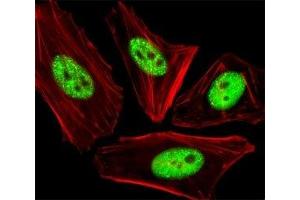 Fluorescent image of HeLa cells stained with phospho-CDC25A antibody at 1:25 dilution. (CDC25A antibody  (pThr507))