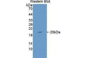 Figure. (GMFB antibody  (AA 2-142))