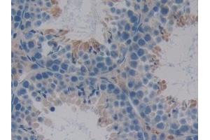 Detection of SERPINA10 in Mouse Testis Tissue using Polyclonal Antibody to Serpin A10 (SERPINA10) (SERPINA10 antibody  (AA 22-448))