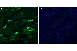 Free-floating frozen brain sections from a paraformaldehyde-perfused mouse were incubated with Anti-Endothelin Receptor A (extracellular) Antibody (ABIN7581867, 1:300), followed by goat anti-rabbit secondary antibody conjugated to Alexa Fluor® 488 (green).