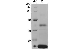 Western Blotting (WB) image for Regenerating Islet-Derived Family, Member 4 (REG4) protein (His tag) (ABIN7320878) (REG4 Protein (His tag))