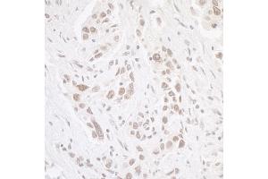 Immunohistochemistry (IHC) image for anti-Casein Kinase 2 alpha 1 (CSNK2A1) (AA 300-350) antibody (ABIN7454514)