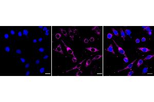 Immunocytochemical staining of HepG2 cells with SEC61A1/2 antibody (ABIN7800968), 1:1,000).