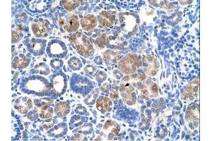 Image no. 1 for anti-Fatty Acid Hydroxylase Domain Containing 2 (FAXDC2) (N-Term) antibody (ABIN6736644) (C5ORF4 antibody  (N-Term))