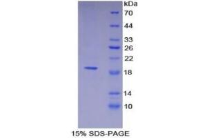 SDS-PAGE (SDS) image for Thrombomodulin (THBD) ELISA Kit (ABIN6730904)