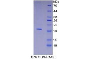 SDS-PAGE of Protein Standard from the Kit  (Highly purified E. (Thrombomodulin ELISA Kit)