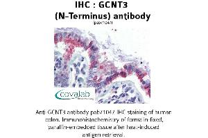 Image no. 2 for anti-Glucosaminyl (N-Acetyl) Transferase 3, Mucin Type (GCNT3) (N-Term) antibody (ABIN1734656) (GCNT3 antibody  (N-Term))