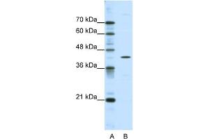 WB Suggested Anti-DOK2 Antibody Titration:  0. (DOK2 antibody  (C-Term))