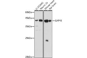 Western blot analysis of extracts of various cell lines, using G antibody (ABIN6127469, ABIN6140954, ABIN6140955 and ABIN6221997) at 1:1000 dilution. (GAP43 antibody  (AA 1-238))