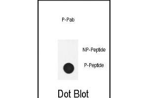 Dot blot analysis of anti-Phospho-Nephrin  antibody Phospho-specific Pab (ABIN650884 and ABIN2839827) on nitrocellulose membrane.