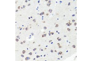 Immunohistochemistry of paraffin-embedded mouse brain using DLG1 antibody (ABIN5996451) at dilution of 1/100 (40x lens).