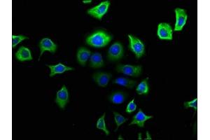 Immunofluorescence staining of A549 cells with ABIN7161414 at 1:166, counter-stained with DAPI.