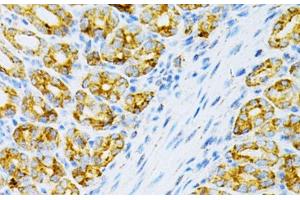 Immunohistochemistry of paraffin-embedded Mouse intestine using OLR1 Polyclonal Antibody at dilution of 1:200 (40x lens). (OLR1 antibody)