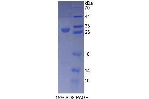 SDS-PAGE (SDS) image for Retinoid X Receptor, gamma (RXRG) (AA 12-220) protein (His tag) (ABIN6237326)