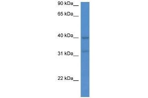 Western Blot showing MTNR1A antibody used at a concentration of 1 ug/ml against Jurkat Cell Lysate (Melatonin Receptor 1A antibody  (C-Term))