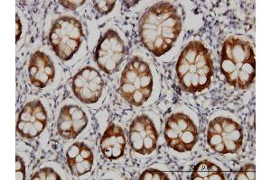 Immunoperoxidase of monoclonal antibody to AKR1B10 on formalin-fixed paraffin-embedded human colon. (AKR1B10 antibody  (AA 76-143))