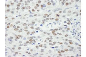 Immunohistochemistry (IHC) image for anti-Mdc1 (MDC1) (AA 1375-1425) antibody (ABIN7448658) (MDC1 antibody  (AA 1375-1425))