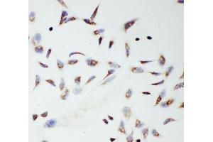 ICC testing of TFAM antibody and HeLa cells (TFAM antibody  (C-Term))