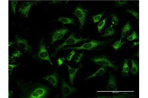 Immunofluorescence of monoclonal antibody to MOAP1 on HeLa cell.