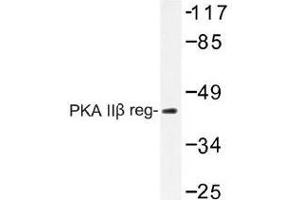Image no. 2 for anti-Protein Kinase, CAMP-Dependent, Regulatory, Type II, beta (PRKAR2B) antibody (ABIN317888) (PRKAR2B antibody)