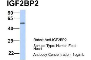 Host:  Rabbit  Target Name:  IGF2BP2  Sample Type:  Human Fetal Heart  Antibody Dilution:  1. (IGF2BP2 antibody  (Middle Region))