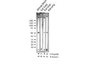 Western blot analysis of Phospho-GSK3 alpha (Ser21) expression in various lysates (GSK3 alpha antibody  (pSer21))