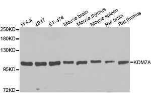 Western blot analysis of extracts of various cell lines, using KDM7A antibody. (JHDM1D antibody)