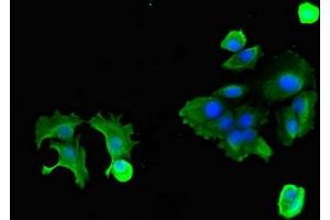 Immunofluorescent analysis of MCF-7 cells using ABIN7162218 at dilution of 1:100 and Alexa Fluor 488-congugated AffiniPure Goat Anti-Rabbit IgG(H+L) (Oncostatin M Receptor antibody  (AA 120-193))