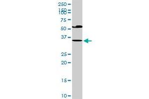 EDA2R MaxPab rabbit polyclonal antibody. (Ectodysplasin A2 Receptor antibody  (AA 1-297))