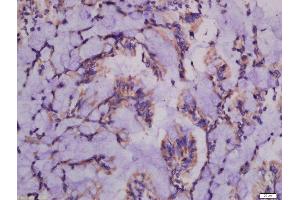 Formalin-fixed and paraffin embedded rat intestine labeled with Anti-ATG101 Polyclonal Antibody, Unconjugated  at 1:300 followed by conjugation to the secondary antibody and DAB staining. (ATG101 antibody  (AA 121-218))
