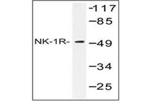 Image no. 1 for anti-Tachykinin Receptor 1 (TACR1) antibody (ABIN317654)